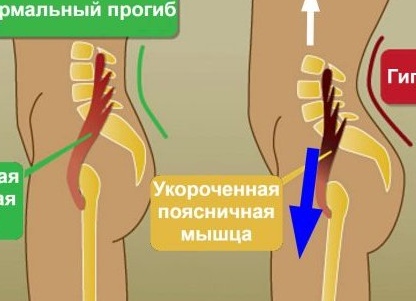 Как сесть на продольный шпагат и зачем это нужно