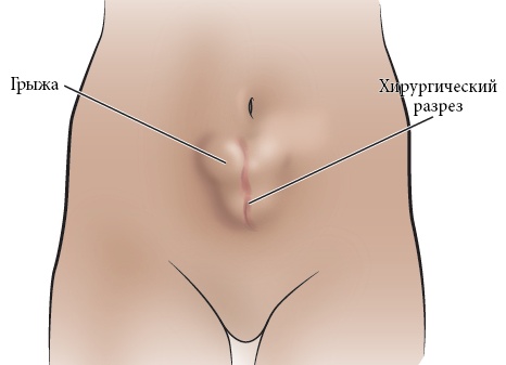 Упражнения, которые помогут сделать ваш живот плоским