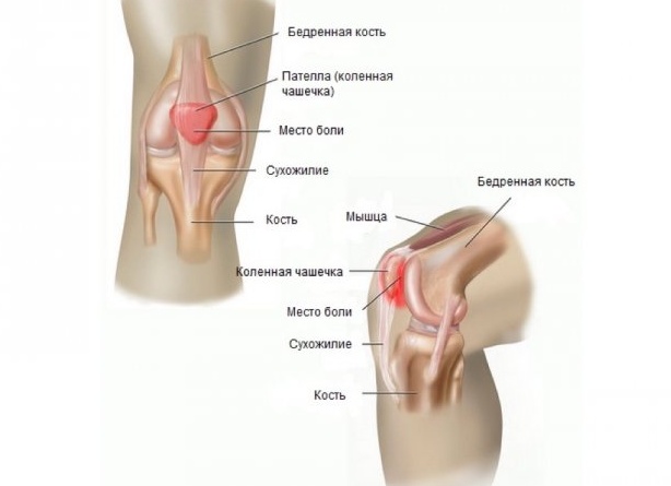 Самые распространённые беговые травмы и как их избежать