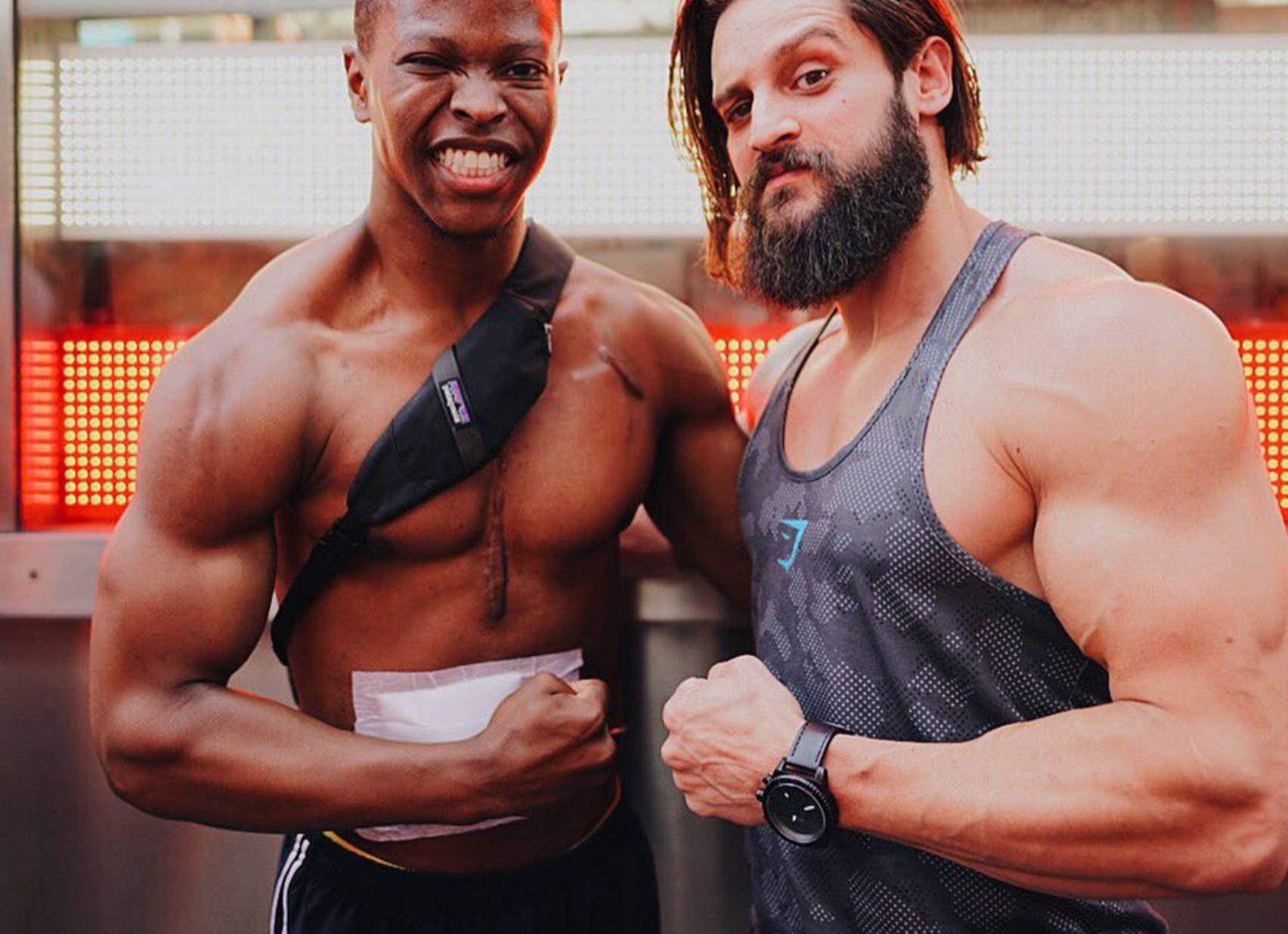 Фитнес-модель Эндрю Джонс и его искусственное сердце: история удивительной стойкости